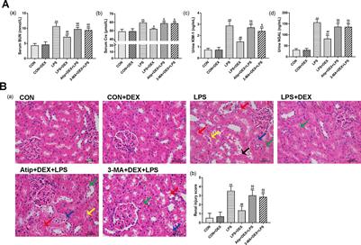 Dexmedetomidine Protects Against Lipopolysaccharide-Induced Acute Kidney Injury by Enhancing Autophagy Through Inhibition of the PI3K/AKT/mTOR Pathway